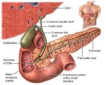 Gallbladder Dysfunction Surgery & Treatment - Eviva